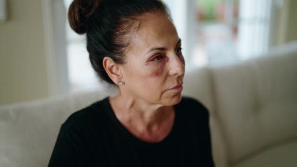 Латиноамериканка Средних Лет Страдающая Домашнего Насилия Синяками Глазах Дома — стоковое видео