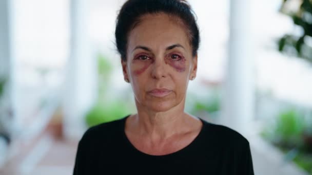 Middelbare Leeftijd Spaanse Vrouw Lijdt Aan Huiselijk Geweld Met Blauwe — Stockvideo
