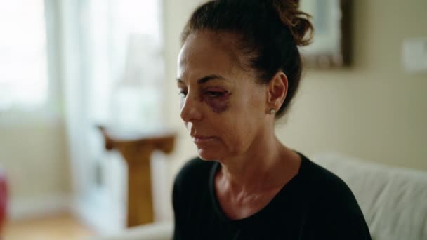 Middle Age Hispanic Woman Suffering Domestic Violence Bruise Eyes Crying — Stok video