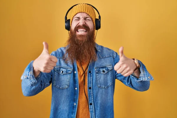Καυκάσιος Άνδρας Μακριά Γενειάδα Ακούγοντας Μουσική Χρησιμοποιώντας Ακουστικά Σημάδι Επιτυχίας — Φωτογραφία Αρχείου
