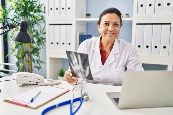 Middle Age Hispanic Woman Wearing Doctor Uniform Holding Xray Clinic — Stock Photo, Image