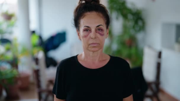 Mujer Hispana Mediana Edad Haciendo Gesto Alto Violencia Doméstica Terraza — Vídeos de Stock