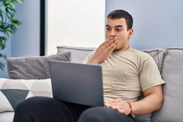 年轻的阿拉伯男子用手捂着嘴在家里用笔记本电脑 感到震惊和害怕犯错 惊讶的表情 — 图库照片