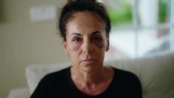 Middle Age Hispanic Woman Suffering Domestic Violence Bruise Eyes Home — Stock Video