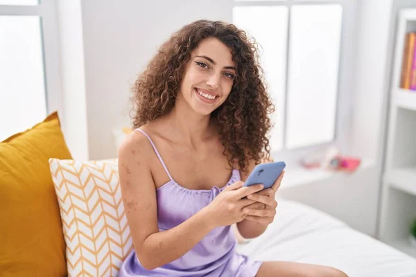 Jonge Mooie Spaanse Vrouw Met Behulp Van Smartphone Zitten Bed — Stockfoto