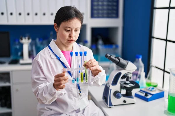 Ung Kvinna Med Syndromet Forskare Håller Provrör Laboratoriet — Stockfoto