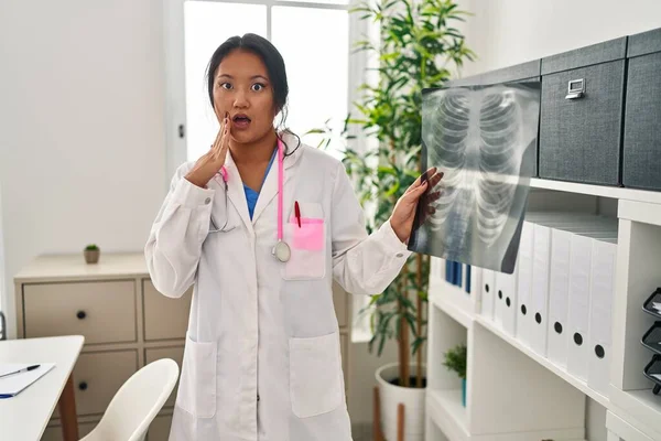 Ung Asiatisk Läkare Kvinna Som Håller Bröst Röntgen Rädd Och — Stockfoto