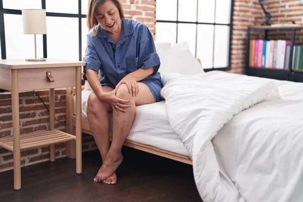 Жінка Середнього Віку Яка Страждає Травмою Коліна Сидить Ліжку Спальні — стокове фото