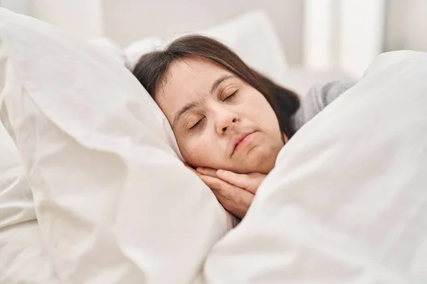 Νεαρή Γυναίκα Σύνδρομο Ξαπλωμένη Στο Κρεβάτι Κοιμάται Στο Υπνοδωμάτιο — Φωτογραφία Αρχείου