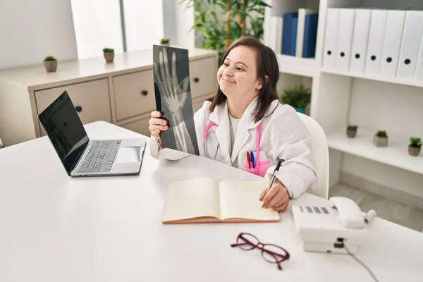 Downs Syndrom Kvinna Bär Läkare Uniform Hålla Röntgen Kliniken — Stockfoto