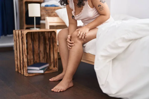 Young Woman Suffering Knee Injury Sitting Bed Bedroom — Fotografia de Stock
