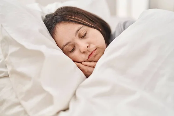 Νεαρή Γυναίκα Σύνδρομο Ξαπλωμένη Στο Κρεβάτι Κοιμάται Στο Υπνοδωμάτιο — Φωτογραφία Αρχείου