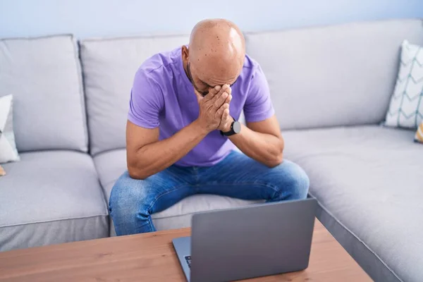 Young Bald Man Stressed Sitting Sofa Home — Stock Photo, Image