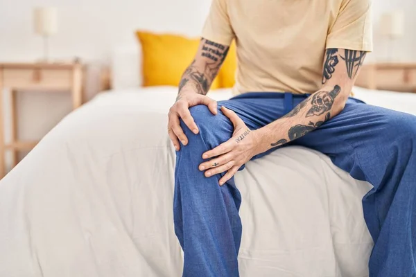 Junger Mann Mit Glatze Liegt Wegen Knieverletzung Schlafzimmer Auf Bett — Stockfoto