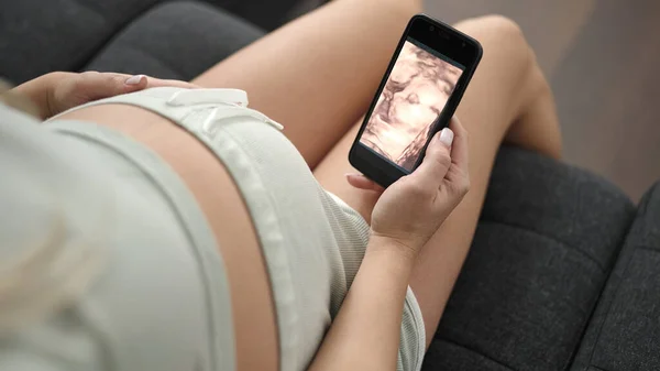 Молодая Беременная Женщина Трогает Живот Глядя Ребенка Ультразвук Дома — стоковое фото