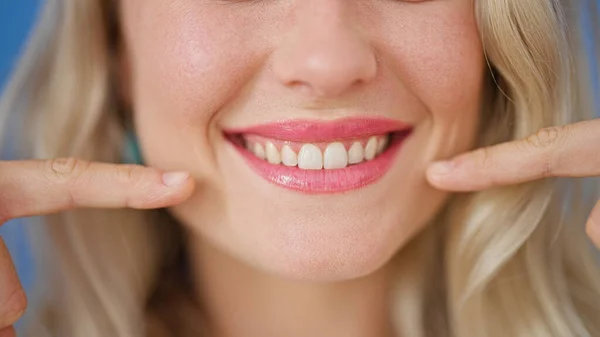 年轻的金发女人用手指指着孤立的蓝色背景上的牙齿 — 图库照片