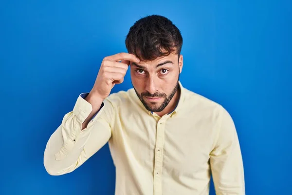 Handsome Hispanic Man Standing Blue Background Pointing Unhappy Pimple Forehead — Stock Photo, Image