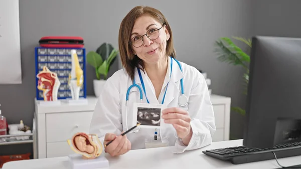 Middle Age Hispanic Woman Doctor Showing Ultrasound Clinic — Stock Photo, Image