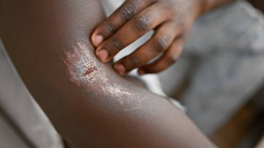 Afro-Amerikalı bir adam koltuğunda oturmuş kolundaki yaraya dokunuyor.