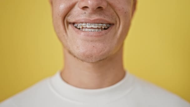 Повседневный Молодой Латиноамериканец Излучает Радость Уверенно Сверкая Ортодонтическими Брекетами Улыбаясь — стоковое видео