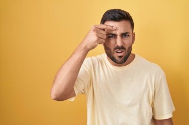 Sarı arka planda dikilen yakışıklı İspanyol adam alnında sivilceden mutsuz siyah nokta enfeksiyonuna işaret ediyor. sivilce ve deri problemi 