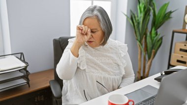 Ofiste gözlerini ovuşturan, iş yerinde yorgunluk ya da baş ağrısı çeken stresli bir son sınıf öğrencisi..