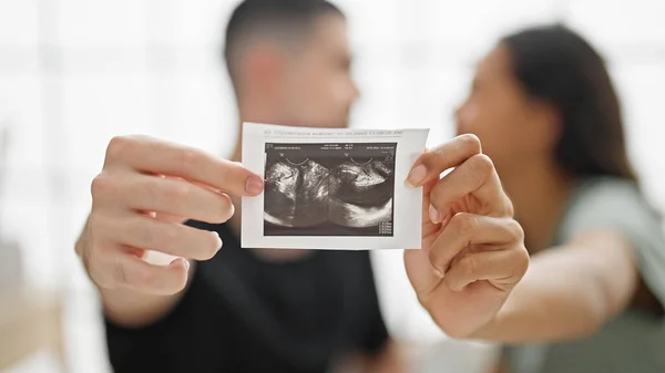 Beautiful Couple Holding Ultrasound Baby Sitting Bed Kissing Bedroom — Stock Photo, Image