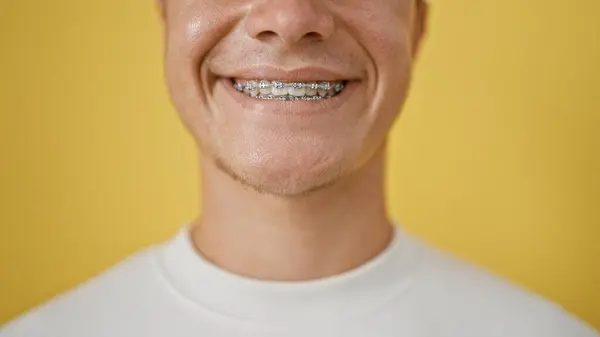 Casual Young Hispanic Teenager Radiates Joy Confidently Flashing His Orthodontic — Stock Photo, Image