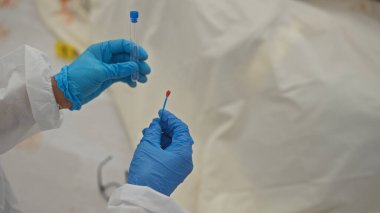 Koruyucu eldivenler giymiş biri klinik test ortamında kan örneği tutuyor..
