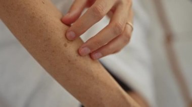 Bir kaplıca salonunun iyi aydınlatılmış odasında kol benlerini inceleyen bir kadın, çillere odaklanarak ellerini ve cilt detaylarını ön plana çıkarıyor..