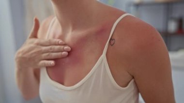 Güneş yanığı tenini, parlak bir spa odasında losyonla rahatlatan bir kadın. Göğsünde görünür kalp dövmesi ve güneş yanığı izleri var. Sağlık merkezinde beyaz bir atlet giyiyor.