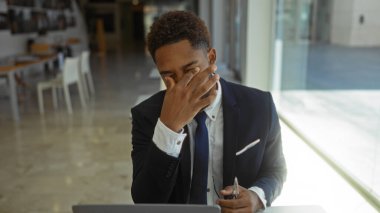 Ofiste oturan takım elbiseli genç adam alnını tutarken stresli görünüyor, geniş pencerelerden görülebilen bulanık modern çalışma alanı arka planıyla