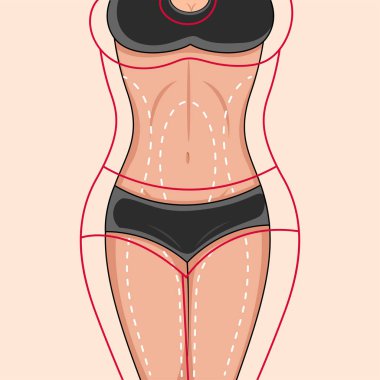 Liposuction prosedüründen önce ve sonra kadın vücudunun farklı olduğunu gösteren bir çizim. Kilo kaybı ve sağlık konsepti