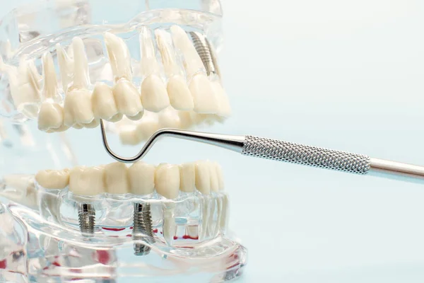 牙科工具与模型在牙科护理概念 — 图库照片