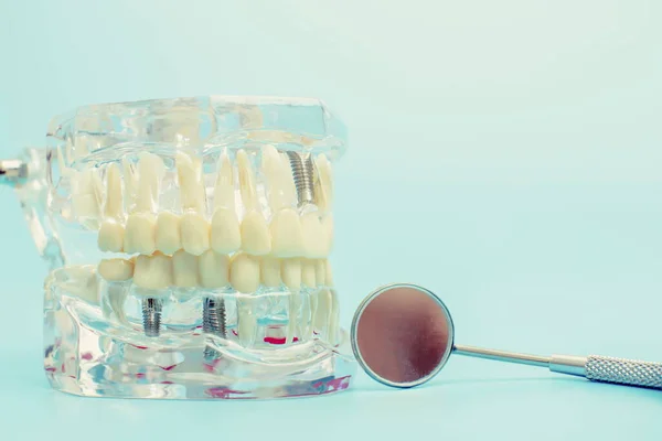 Narzędzie Dentystyczne Modelem Koncepcji Opieki Stomatologicznej — Zdjęcie stockowe