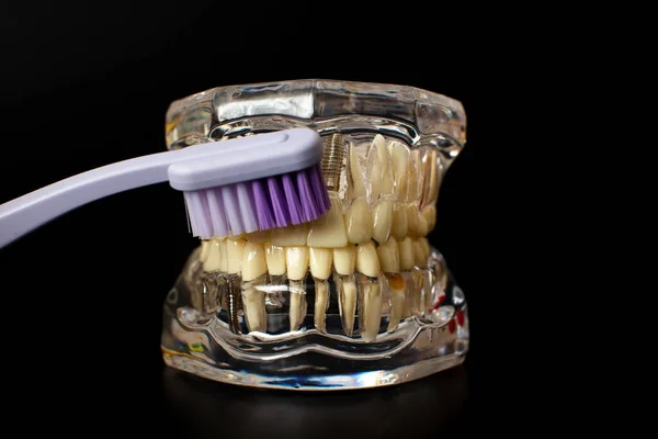 Dentista Dentes Protéticos Dentários Gengivas Raízes Close Estudo Conceito Doenças — Fotografia de Stock