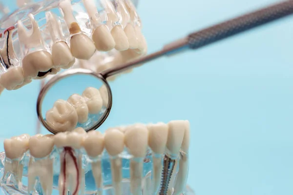 牙科工具与模型在牙科护理概念 — 图库照片