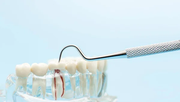 Diş Bakımı Konseptinde Modelli Diş Aleti — Stok fotoğraf