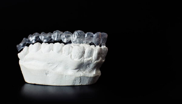 Dental jaw model over black background.Transparent invisible dental aligners or braces aplicable for an orthodontic dental treatment
