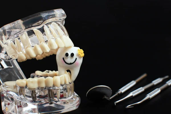 Dental Jaw Model Black Background Transparent Invisible Dental Aligners Braces — Stock Photo, Image