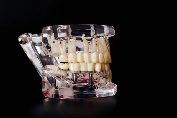 Dentista Dental Protésica Dientes Encías Raíces Primer Plano Estudiar Concepto —  Fotos de Stock