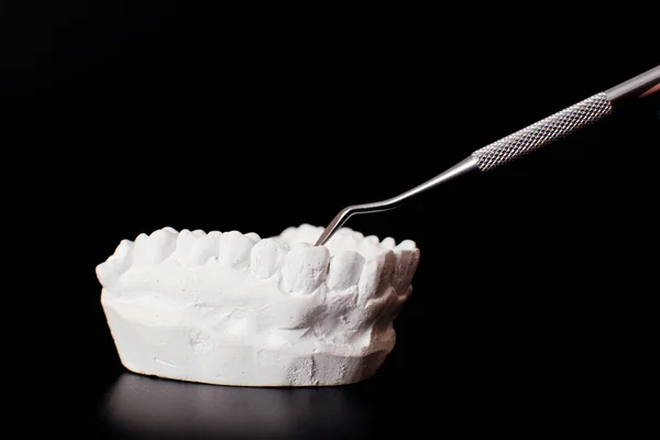 Dentiste Prothèses Dentaires Dents Gencives Racines Gros Plan Étude Concept — Photo