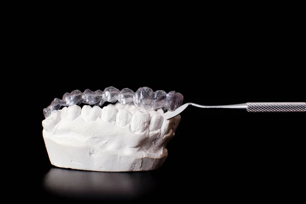 Dentysta Protezy Zębów Dziąsła Korzenie Zbliżenie Badanie Koncepcji Chorób Zębów — Zdjęcie stockowe