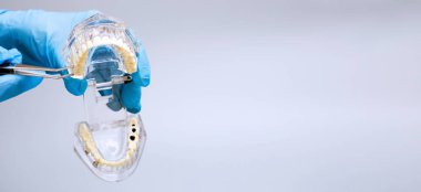 In hand dentists dental teeth teaching model showing each tooth, gum, root, implant, decay, plaque and enamel.