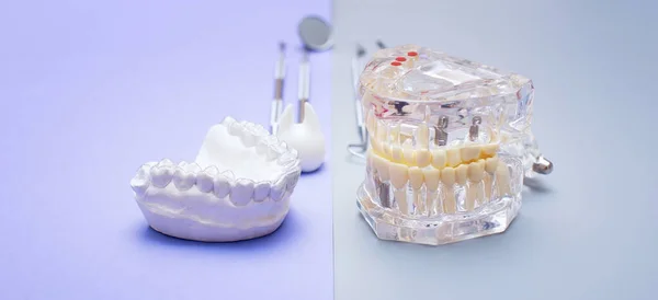 Dental tools and model of teeth on a blue background. Dental care concept.