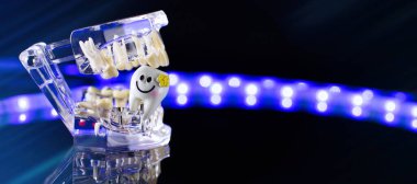 Siyah arkaplan üzerinde diş çene modeli. Ortodontik diş tedavisi için kullanılabilir şeffaf görünmez diş hizalayıcıları veya diş telleri