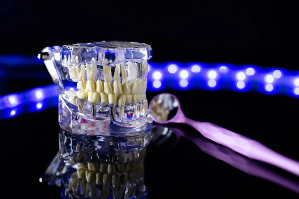 Zahnkiefermodell Auf Schwarzem Hintergrund Transparente Unsichtbare Zahnausrichtungen Oder Zahnspangen Die — Stockfoto