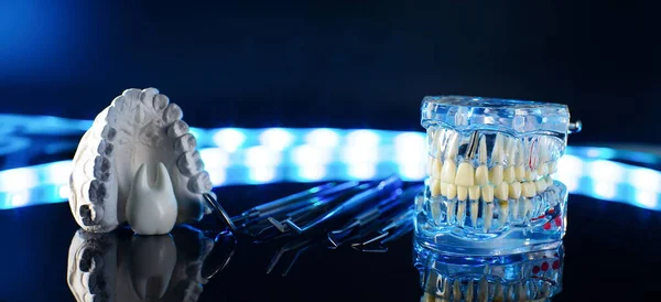 Zahnwerkzeuge Und Zahnmodell Auf Neonfarbenem Hintergrund — Stockfoto