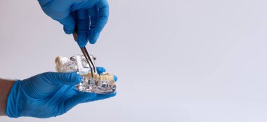 Mavi eldivenli doktorun elinde beyaz bir diş modeli var.