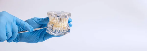 Mão Dentistas Dentes Dentários Modelo Ensino Mostrando Cada Dente Goma — Fotografia de Stock